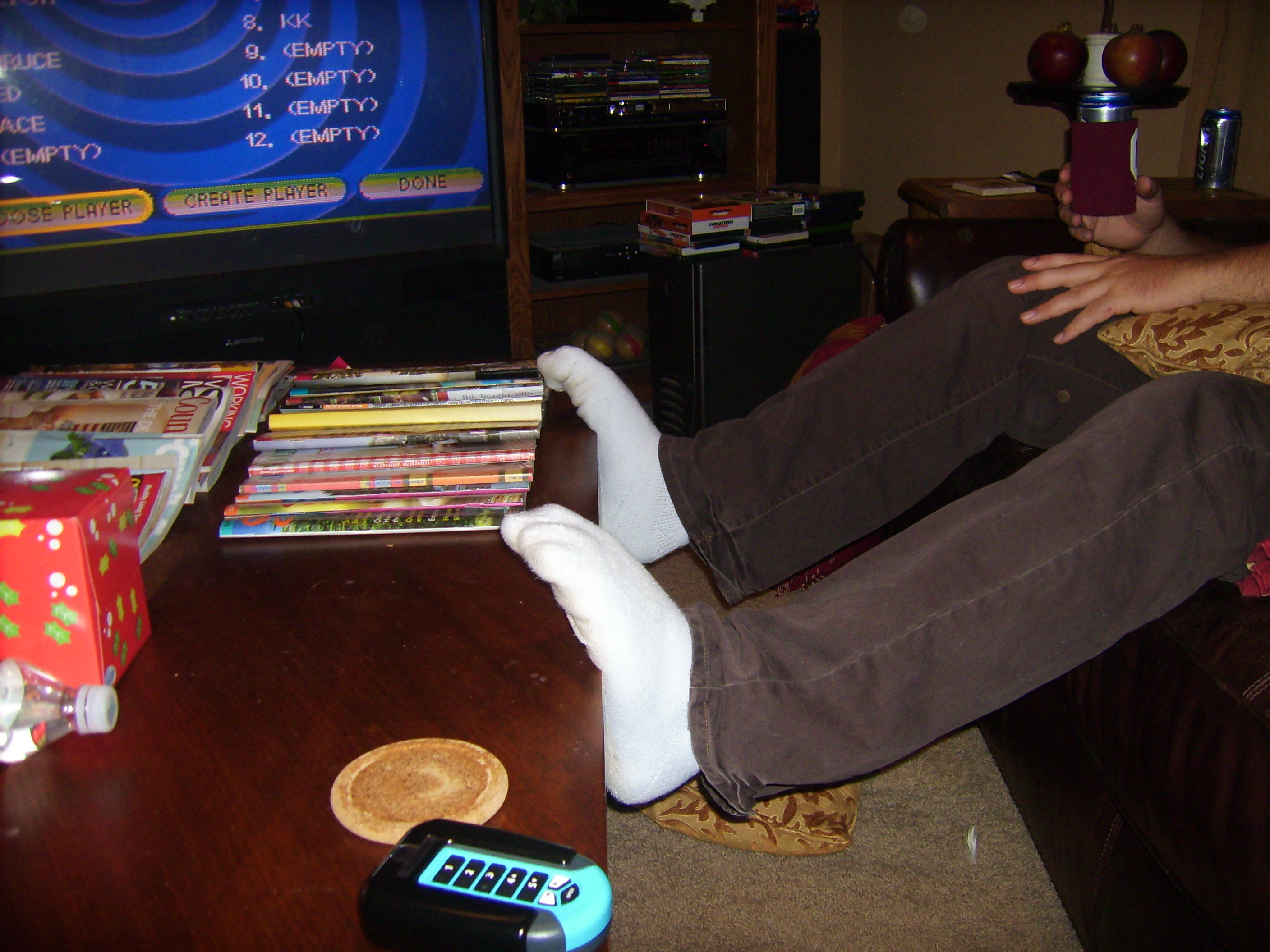 Ed's abnormal feet