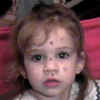 What Holly would look like with the Pox.jpg (15454 bytes)